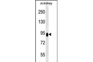ZBTB41 Antibody (Center) (ABIN654501 and ABIN2844232) western blot analysis in mouse kidney tissue lysates (35 μg/lane).