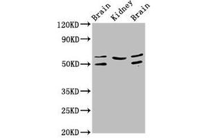 Western Blot Positive WB detected in: Rat brain tissue, Rat kidney tissue, Mouse brain tissue All lanes: ANGPT2 antibody at 3. (Angiopoietin 2 抗体  (AA 19-485))