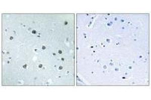 Immunohistochemistry analysis of paraffin-embedded human brain tissue using MYO1D antibody. (Myosin ID 抗体)