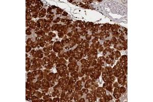 Immunohistochemical staining of human pancreas with HARBI1 polyclonal antibody  shows strong cytoplasmic positivity in exocrine glandular cells at 1:500-1:1000 dilution. (HARBI1 抗体)