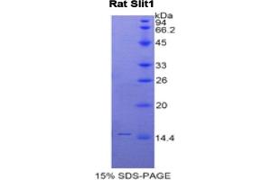 SDS-PAGE analysis of Rat Slit Homolog 1 Protein. (SLIT1 蛋白)