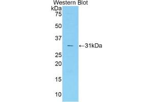 Western blot analysis of the recombinant protein. (Coagulation Factor V 抗体  (AA 1776-2028))