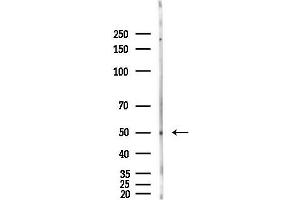 Western blot analysis of lysates from Hela cells(heat-shock,45 min treatment), using Cytokeratin 14 Antibody at 1/1000 dilution.