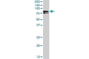 LIMK1 monoclonal antibody (M01), clone 1A8. (LIM Domain Kinase 1 抗体  (AA 548-647))