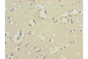 Immunohistochemistry (IHC) image for anti-COX17 Cytochrome C Oxidase Assembly Protein 17 (COX17) (AA 1-63) antibody (ABIN7149150)