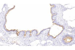 Detection of RALBP1 in Human Lung Tissue using Polyclonal Antibody to RalA Binding Protein 1 (RALBP1) (RALBP1 抗体  (AA 403-499))