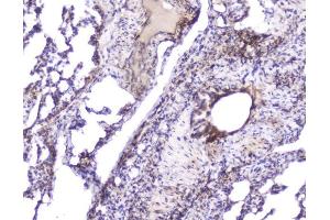 IHC analysis of Hsp27 using anti-Hsp27 antibody (ABIN6719322). (HSP27 抗体  (AA 1-209))