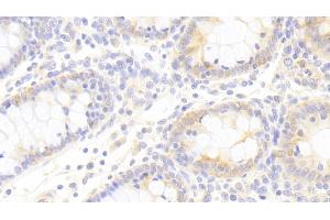 Immunohistochemistry (IHC) image for anti-Toll-Interleukin 1 Receptor (TIR) Domain Containing Adaptor Protein (TIRAP) (AA 1-221) antibody (ABIN7441712)
