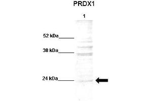 Western Blotting (WB) image for anti-Peroxiredoxin 1 (PRDX1) (N-Term) antibody (ABIN2773920)