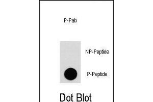 Dot blot analysis of anti-EGFR-p Phospho-specific Pab (ABIN1881285 and ABIN2850456) on nitrocellulose membrane. (EGFR 抗体  (pTyr1092))