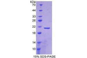 SDS-PAGE (SDS) image for Laminin, beta 2 (Laminin S) (LAMB2) (AA 75-223) protein (His tag) (ABIN2125588)
