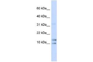 WB Suggested Anti-IL15 Antibody Titration: 0. (IL-15 抗体  (N-Term))