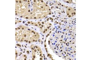 Immunohistochemistry of paraffin-embedded human kidney using HIRIP3 antibody (ABIN5974221) at dilution of 1/100 (40x lens). (HIRIP3 抗体)