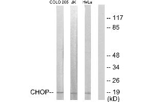 Immunohistochemistry analysis of paraffin-embedded human skeletal muscle tissue using CHOP (Ab-30) antibody. (DDIT3 抗体  (Ser30))