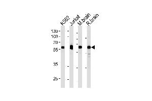 USP14 Antibody (N-term) (ABIN1882288 and ABIN2843485) western blot analysis in k562,Jurkat cell line ,mouse brain and rat brain tissue lysates (35 μg/lane). (USP14 抗体)