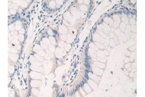 Immunohistochemistry (IHC) image for anti-Solute Carrier Family 12 (Sodium/Chloride Transporters), Member 3 (SLC12A3) (AA 867-1024) antibody (ABIN7441745)