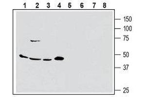 Western blot analysis of human MCF-7 breast adenocarcinoma (lanes 1 and 5), human Colo-205 colorectal adenocarcinoma (lanes 2 and 6), human PANC-1 pancreas ductal adenocarcinoma (lanes 3 and 7) and human Malme-3M melanoma cell line lysate (lanes 4 and 8): - 1-4. (SLC1A5 抗体  (2nd Extracellular Loop))