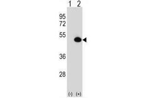 Western blot analysis of ASS1 (arrow) using rabbit polyclonal ASS1 Antibody (C-term) . (ASS1 抗体  (C-Term))