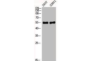 Western Blot analysis of 293T 22RV1 cells using Phospho-Akt1 (Y474) Polyclonal Antibody (AKT1 抗体  (pTyr474))