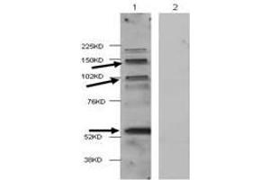 Western Blot of Rabbit anti-HDAC4 antibody. (HDAC4 抗体  (Internal Region))