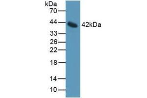 Detection of IL11Ra in Mouse Serum using Polyclonal Antibody to Interleukin 11 Receptor Alpha (IL11Ra) (IL11RA 抗体  (AA 194-329))