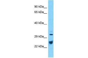 Western Blotting (WB) image for anti-ATPase, Na+/K+ Transporting, beta 1 Polypeptide (ATP1B1) (C-Term) antibody (ABIN5514516)