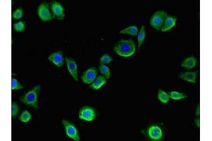 Immunofluorescent analysis of PC-3 cells using ABIN7148281 at dilution of 1:100 and Alexa Fluor 488-congugated AffiniPure Goat Anti-Rabbit IgG(H+L) (MMP13 抗体  (AA 104-471))
