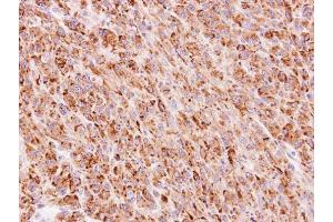 IHC-P Image Immunohistochemical analysis of paraffin-embedded U87 xenograft, using TTC30A, antibody at 1:100 dilution. (TTC30A 抗体)