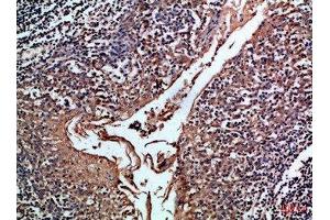 Immunohistochemical analysis of paraffin-embedded Human-tonsil, antibody was diluted at 1:100 (CD24 抗体  (AA 30-60))