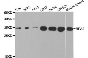 Western blot analysis of extracts of various cell lines, using RPA2 antibody. (RPA2 抗体)