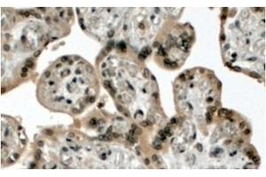 AP32078PU-N MLL2 Antibody staining of paraffin embedded Human Placenta at 4 µg/ml. (MLL2 抗体  (N-Term))