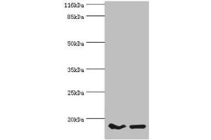 Western blot All lanes: POP7 antibody at 10 μg/mL Lane 1: Hela whole cell lysate Lane 2: HepG2 whole cell lysate Secondary Goat polyclonal to rabbit IgG at 1/10000 dilution Predicted band size: 16 kDa Observed band size: 16 kDa (POP7 抗体  (AA 1-140))