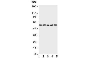 Western blot testing of Syndecan 3 antibody and Lane 1: human U87;  2: (h) 293T;  3: rat PC12;  4: (r) NRK;  5: (h) HT1080 cell lysate (SDC3 抗体  (N-Term))