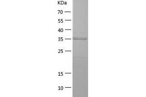 Western Blotting (WB) image for Homer Homolog 3 (Drosophila) (HOMER3) (AA 1-361) protein (His tag) (ABIN7289041) (HOMER3 Protein (AA 1-361) (His tag))