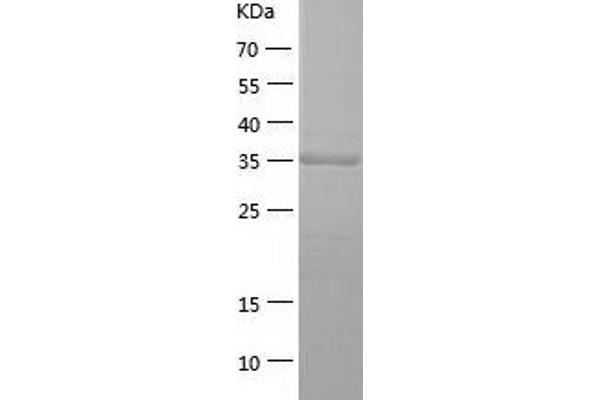 HOMER3 Protein (AA 1-361) (His tag)