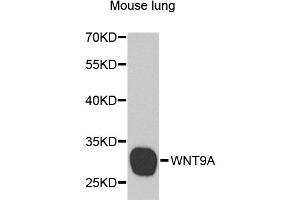 Western blot analysis of extracts of mouse lung, using WNT9A antibody. (WNT9A 抗体)