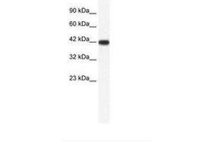 Image no. 1 for anti-Integrin-Binding Sialoprotein (IBSP) (AA 108-157) antibody (ABIN202229) (IBSP 抗体  (AA 108-157))