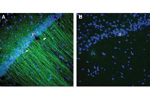 Expression of CCR2 in rat hippocampus.