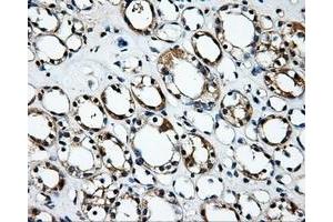 Immunohistochemical staining of paraffin-embedded Kidney tissue using anti-RALBP1mouse monoclonal antibody. (RALBP1 抗体)