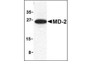 Western blot analysis of MD-2 in mouse spleen cell lysate with this product at 1 μg/ml.