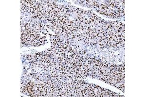 IHC analysis of FEN1 using anti-FEN1 antibody (ABIN7601617). (FEN1 抗体  (AA 4-300))
