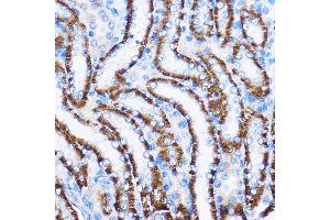 Immunohistochemistry (IHC) image for anti-Interleukin 23 Receptor (IL23R) (AA 405-629) antibody (ABIN3022246)