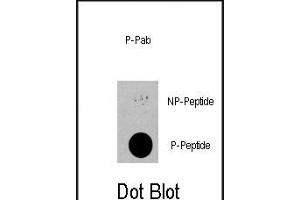 Dot blot analysis of anti-PDPK1-p Phospho-specific Pab (R) on nitrocellulose membrane. (PDPK1 抗体  (pSer396))