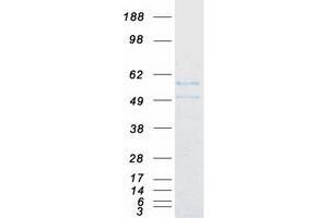 Western Blotting (WB) image for FLT3-Interacting Zinc Finger 1 (FIZ1) protein (Myc-DYKDDDDK Tag) (ABIN2721200)