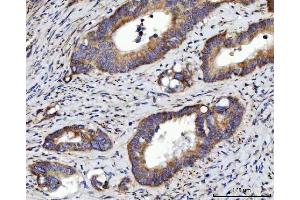 IHC analysis of RRS1 using anti-RRS1 antibody (ABIN7602918). (RRS1 抗体  (C-Term))
