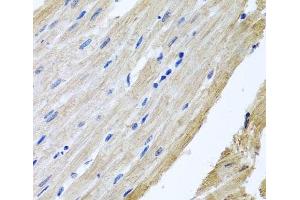 Immunohistochemistry of paraffin-embedded Rat heart using PRPH Polyclonal Antibody at dilution of 1:100 (40x lens). (Peripherin 抗体)