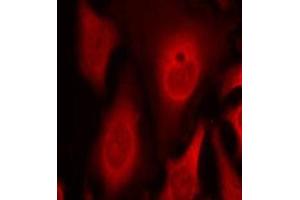 Immunofluorescence staining of methanol-fixed Hela cells using phospho-EIF2S1-S49 antibody. (EIF2S1 抗体  (pSer49))