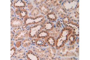 IHC-P analysis of kidney tissue, with DAB staining. (LOXL4 抗体  (AA 399-552))