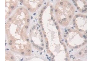 Immunohistochemistry (IHC) image for anti-Syntaxin 1A (Brain) (STX1A) (AA 1-255) antibody (ABIN7440974)