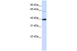 PHF6 antibody used at 0. (PHF6 抗体  (C-Term))